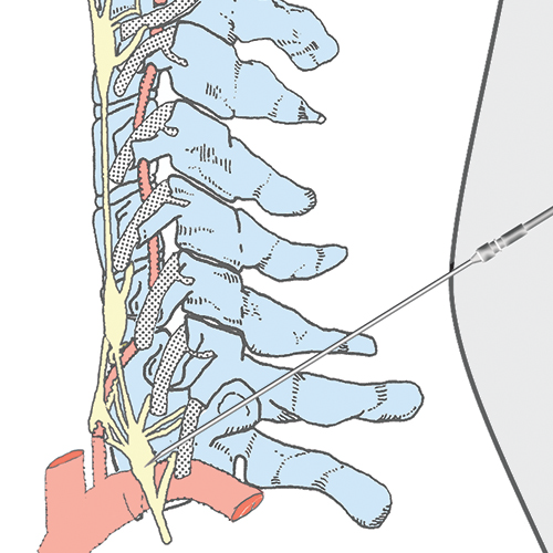 Medical Illustration
